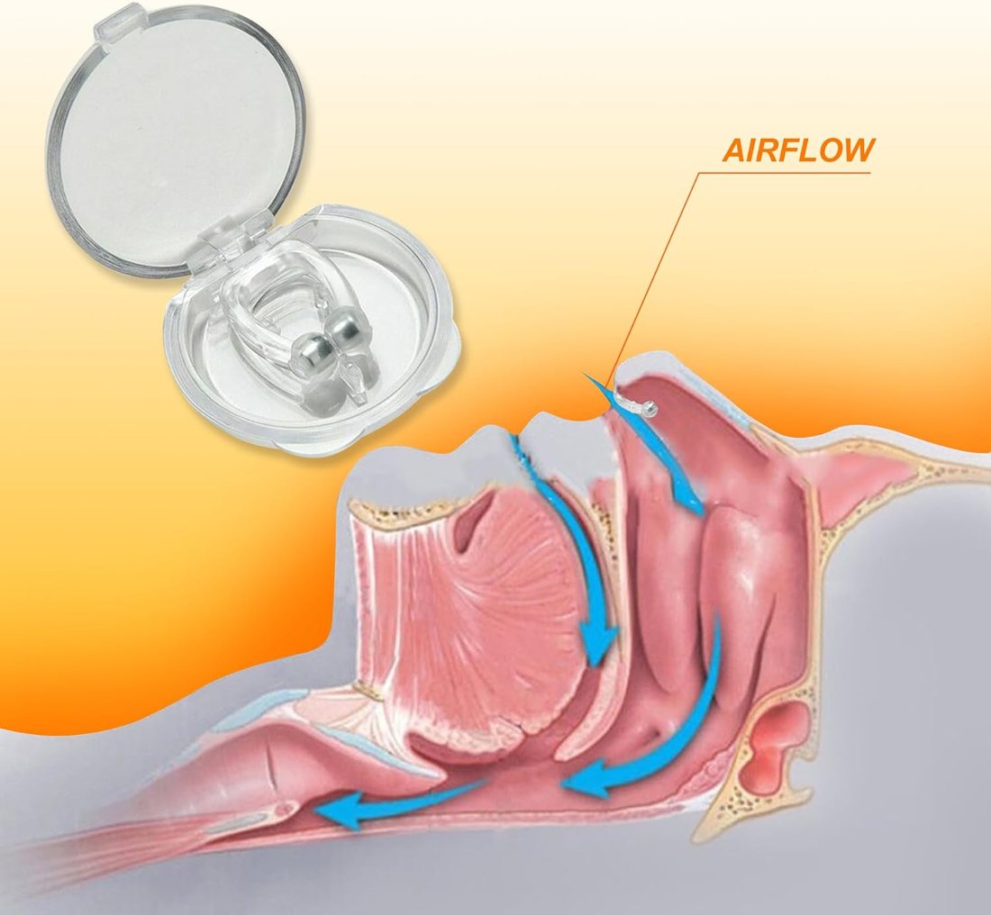 Anti-Snore Kit — 30 Pieces, view 4
